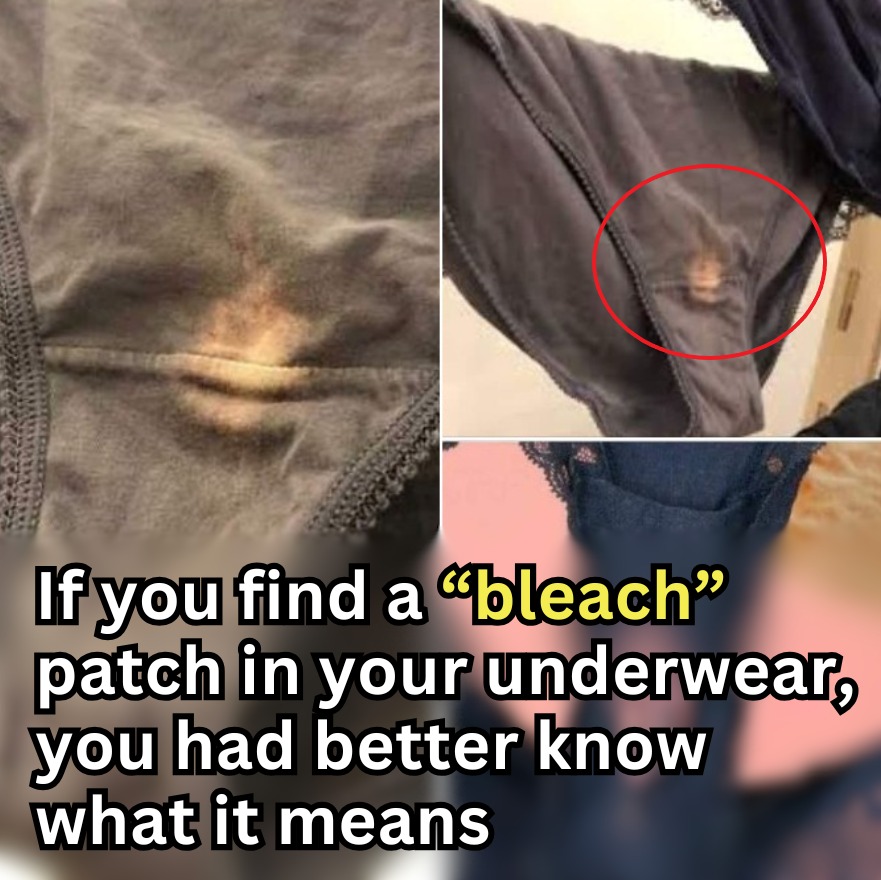 Here’s what it means if you find a “bleach” patch on your underwear