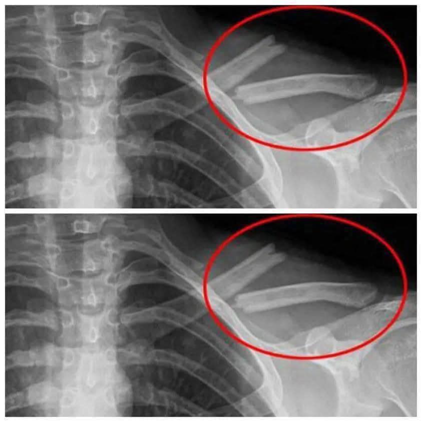 this-drink-will-destroy-your-bones